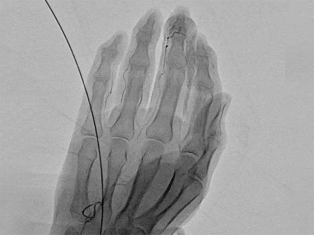 “当院で新しく始まる治療”<br>保存療法で改善が乏しかった痛みに、新たな選択肢を